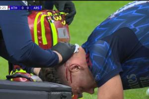 挂彩了！加布里埃尔争顶与约克雷斯头撞头，把约克雷斯头撞流血了