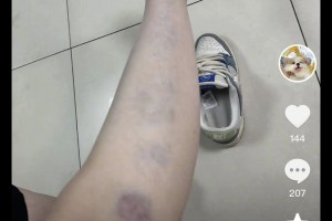 🍉涉及篮球女主播？解说员孔祥宇妻子社媒晒家暴痕迹&申请离婚